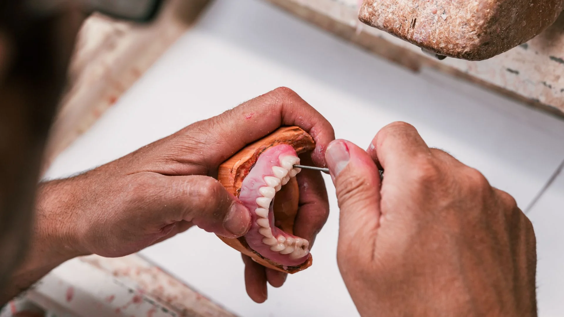 protesis dentales (3)